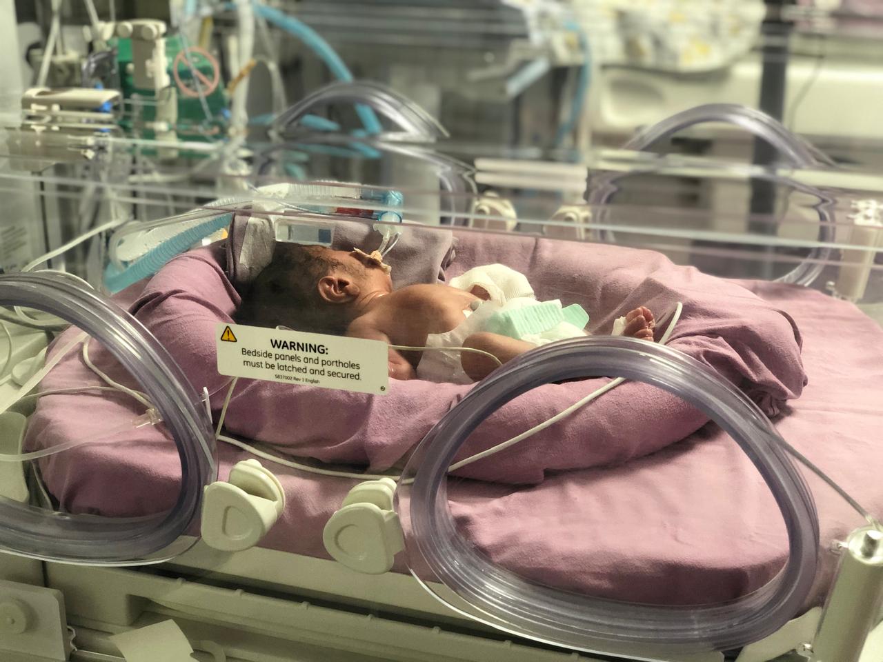 Newborn infant under observation in NICU
